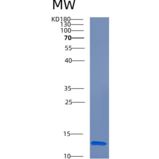 人CRIPT重组蛋白