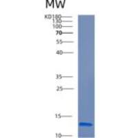 人CRIPT重组蛋白