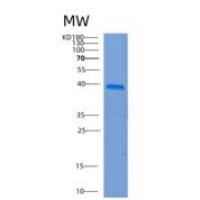 人COP9组成型光形态发生同源物亚基6(COPS6)重组蛋白