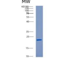 人C反应蛋白(CRP)重组蛋白