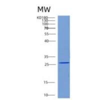 人CHMP2A重组蛋白