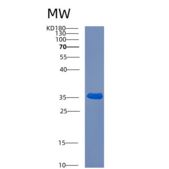 人Crk样蛋白(CRKL)重组蛋白