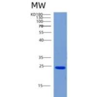 人软骨凝集蛋白(CHODL)重组蛋白