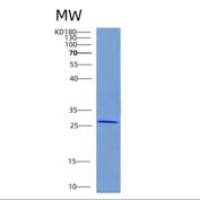 人CHMP2B重组蛋白