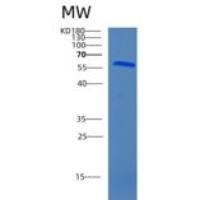 小鼠肌肽酶1(CNDP1)重组蛋白
