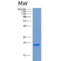 人COMMD7重组蛋白