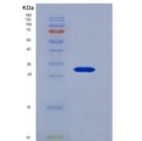 人睫状神经营养因子(CNTF)重组蛋白