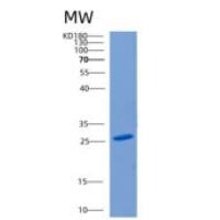 人CLEC10A重组蛋白
