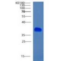人CIAPIN1重组蛋白