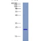 人CRYGD重组蛋白