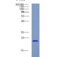 人CRYGD重组蛋白