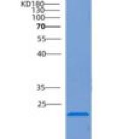 人COMMD1重组蛋白