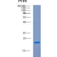人COPZ1重组蛋白
