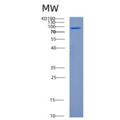 人半胱氨酸tRNA合成酶重组蛋白