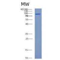 人半胱氨酸tRNA合成酶重组蛋白