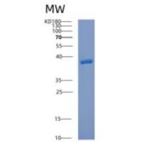 人含钙调磷酸酶样磷酸酯酶域蛋白1(CPPED1)重组蛋白