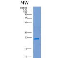 人COMMD9重组蛋白