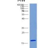 人CHRHSP1重组蛋白