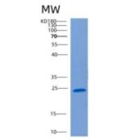 人心营养素样细胞因子1(CLCF1)重组蛋白