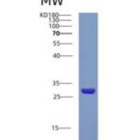 人晶状体蛋白βB1(CRYbB1)重组蛋白