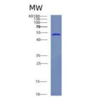 人C-Src酪氨酸激酶(CSK)重组蛋白