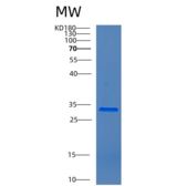 人钙调宁蛋白1(CNN1)重组蛋白