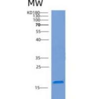 人复合素1(CPLX1)重组蛋白