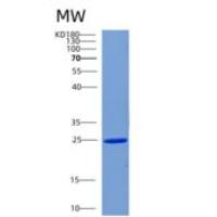 人CHMP1B重组蛋白