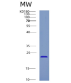 人CRYGD重组蛋白