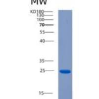 大鼠睫状神经营养因子(CNTF)重组蛋白