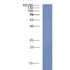 人半胱氨酸丰富蛋白1(CRIP1)重组蛋白