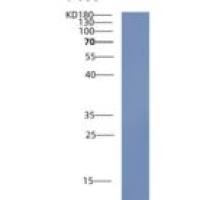 人半胱氨酸丰富蛋白1(CRIP1)重组蛋白