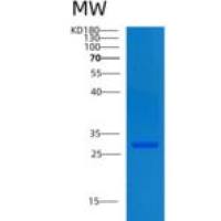 人CNPY4重组蛋白