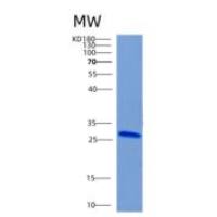 人CHMP5重组蛋白
