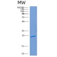 人儿茶酚-O-甲基转移酶(COMT)重组蛋白