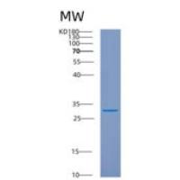 人泛醌生物合成蛋白COQ9，线粒体(COQ9)重组蛋白