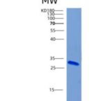 人CHRNA6重组蛋白