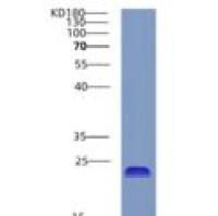 人CRYGC重组蛋白