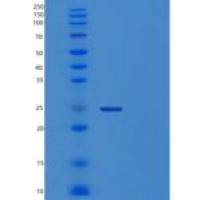 人CRYBA4重组蛋白