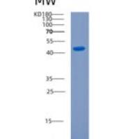 人线粒体肌酸激酶1A(CKMT1A)重组蛋白