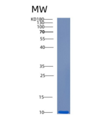 人半胱氨酸丰富蛋白1(CRIP1)重组蛋白