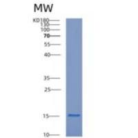 人细胞维甲酸结合蛋白1(CRABP1)重组蛋白
