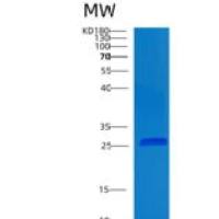 人柯萨奇病毒腺病毒受体样膜蛋白(CLMP)重组蛋白