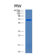 人肌肽酶2(CNDP2)重组蛋白