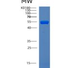 人肌肽酶1(CNDP1)重组蛋白产品图