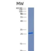 人补体因子D(CFD)重组蛋白