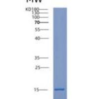 人细胞维甲酸结合蛋白2(CRABP2)重组蛋白