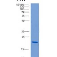 人CLEC5A重组蛋白