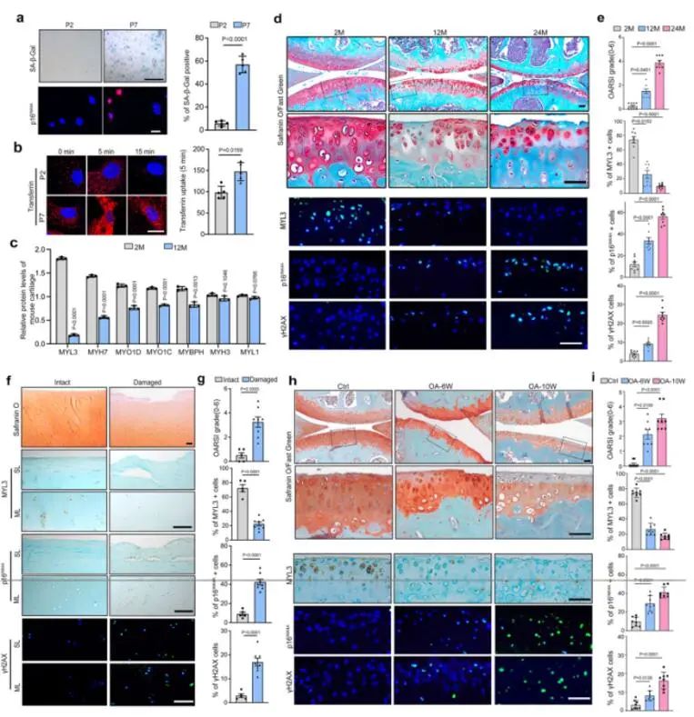 Nat Com丨MYL3保护软骨细胞免于衰老的机制