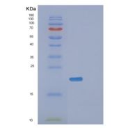 人氨基N-乙酰转移酶1重组蛋白